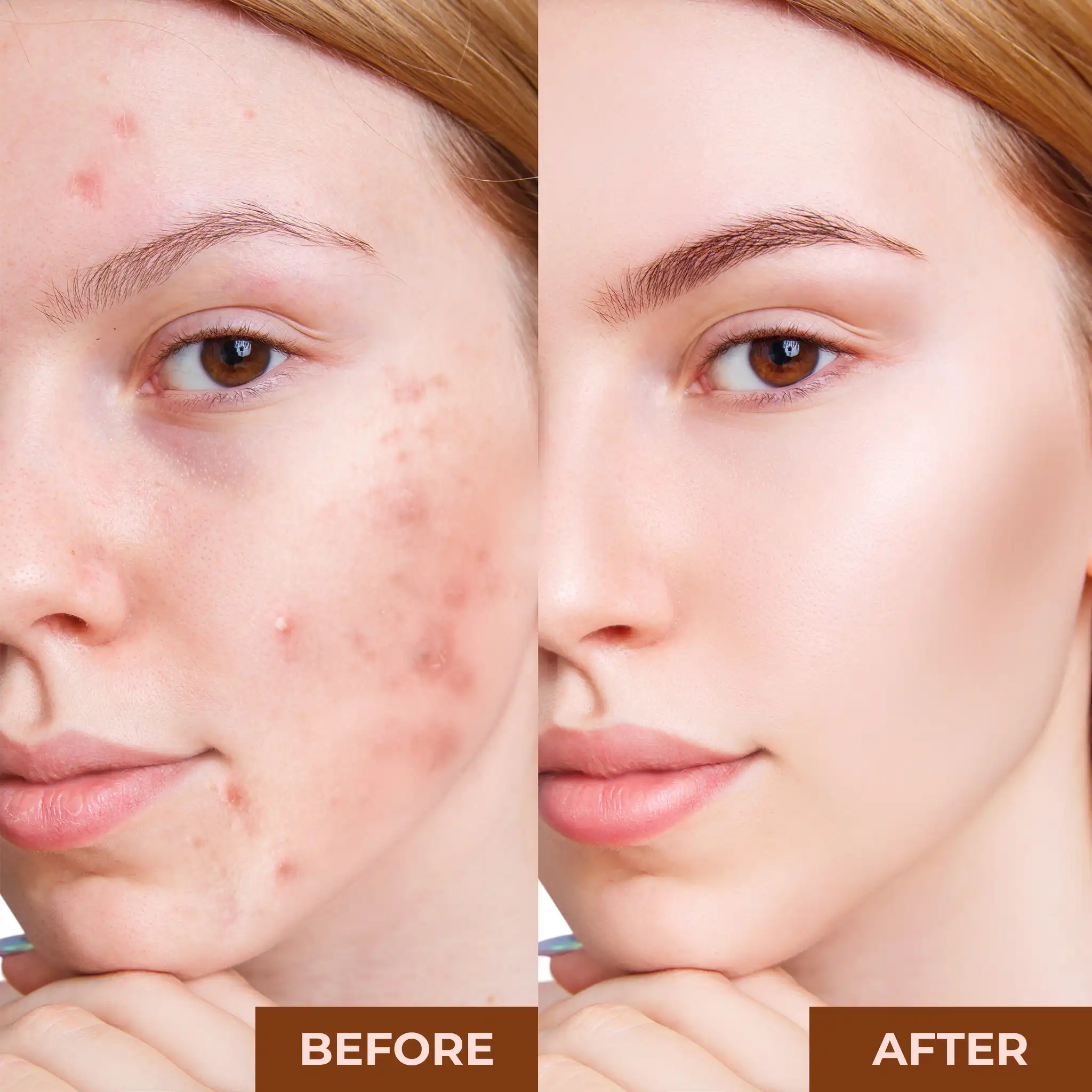 Best Pore Minimizing Primer by Prolux - Image 5